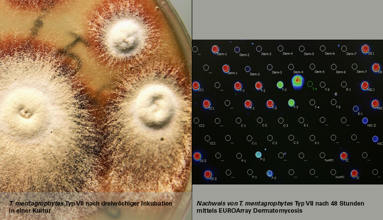 T. mentagrophytes in Kultur und im EUROArray Dermatomycosis